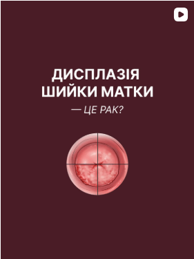 дисплазія шики матки